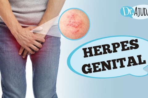 HERPES GENITAL: O que é? Quais sintomas e tratamentos