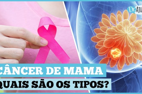 Quais são os tipos de câncer de mama?